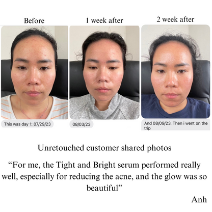 TIGHT AND BRIGHT, an Advanced Gentle Phyto-Retinol and Vitamin C Face Serum, 12 Innovative Technologies, 55% High-Performance Cosmeceuticals