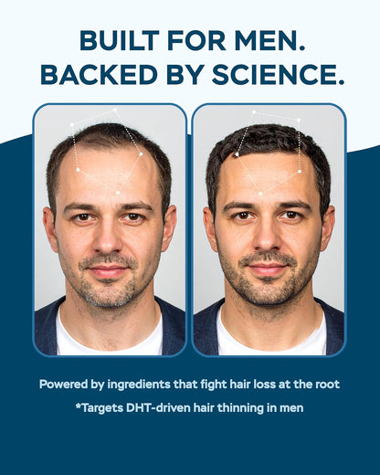 Improved Complex Saw Palmetto for Men 900 mg