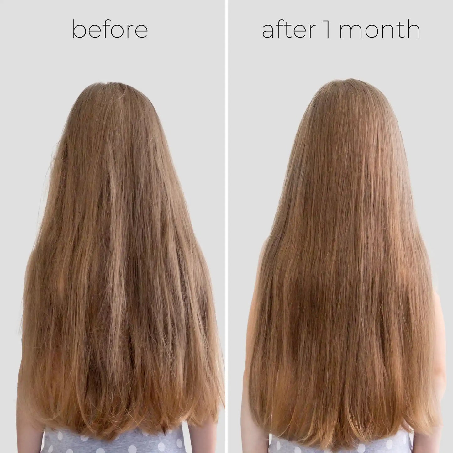 Oil Capsules For Frizzy Hair