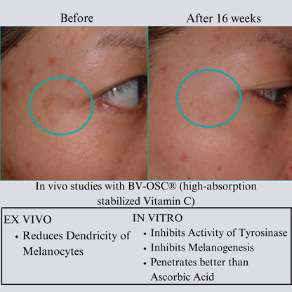 TIGHT AND BRIGHT, an Advanced Gentle Phyto-Retinol and Vitamin C Face Serum, 12 Innovative Technologies, 55% High-Performance Cosmeceuticals