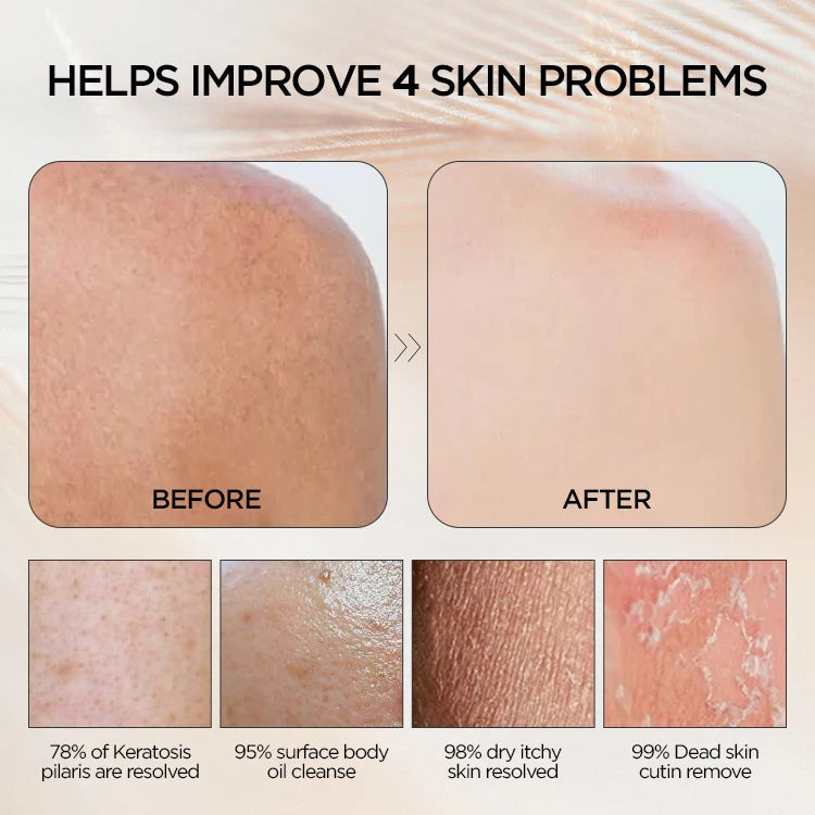 100% Natural Korean Viscose Exfoliating Glove – Deep-Cleansing Body Mitt for Skin Brightening, Smoothing & Whitening | Eco-Friendly & Reusable