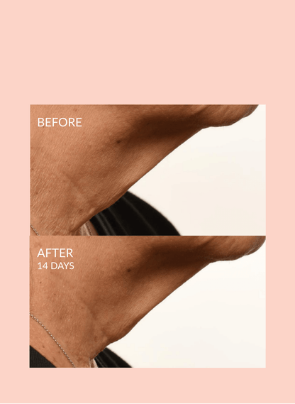 Triple Lift Molecule Mask