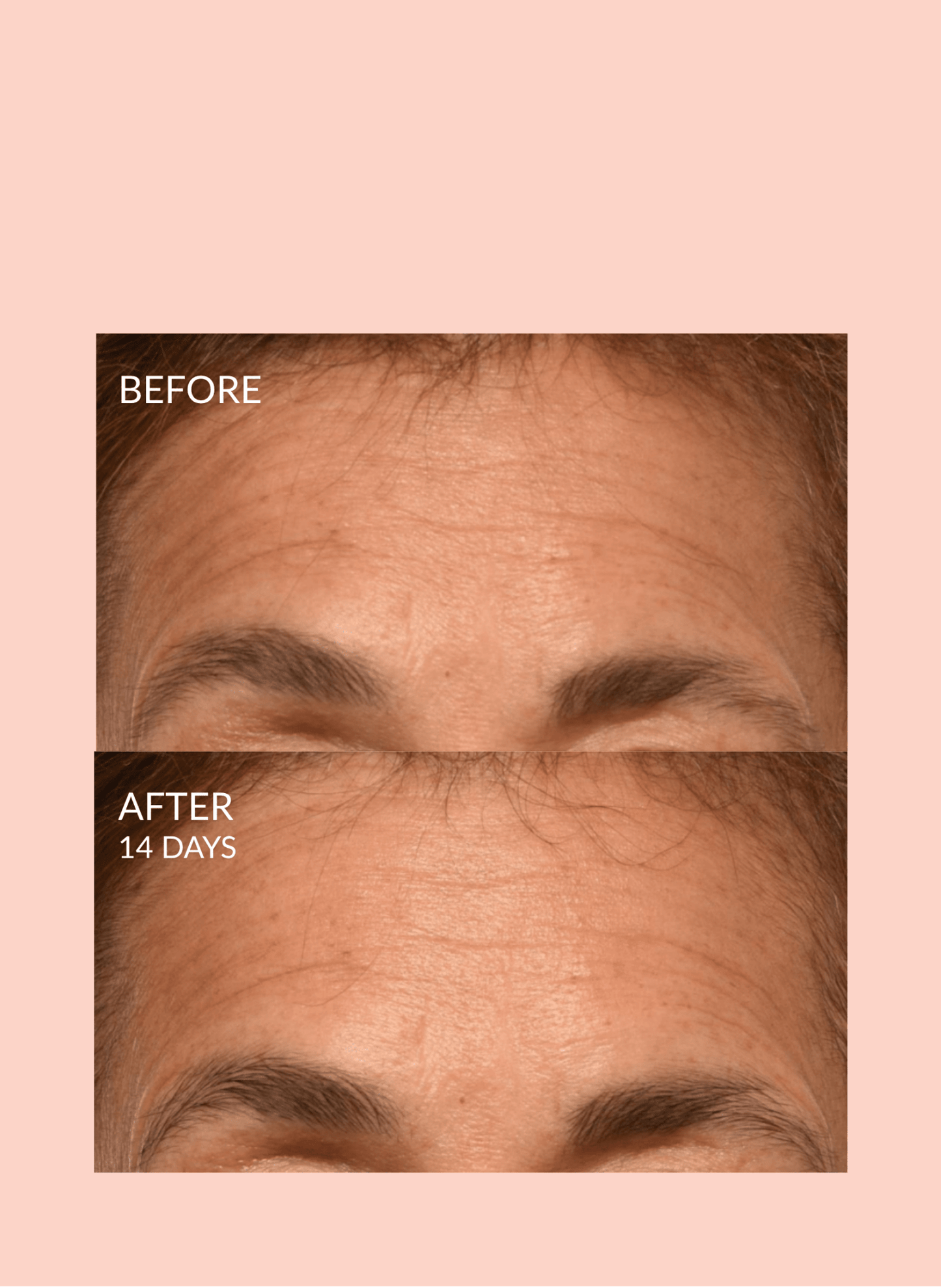 Triple Lift Molecule Mask